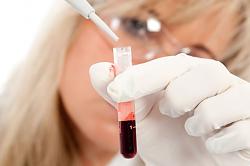 Badanie krwi w ciąży  - morfologia krwi
