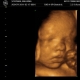 USG - 37 tydzień ciąży