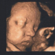 USG - 33 tydzień ciąży