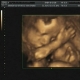 USG - 28 tydzień ciąży